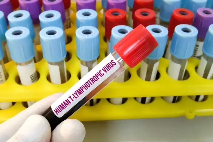 Ministério da Saúde Lança Nota Técnica para Prevenção da Transmissão Vertical do HTLV