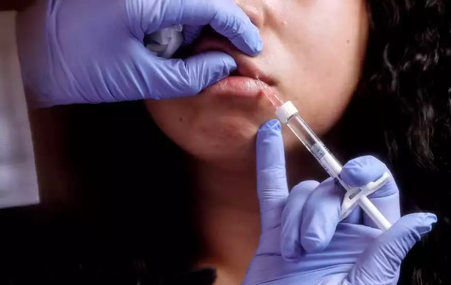 Preenchimento Labial em Adolescentes: Dermatologistas Advertindo sobre Riscos à Saúde