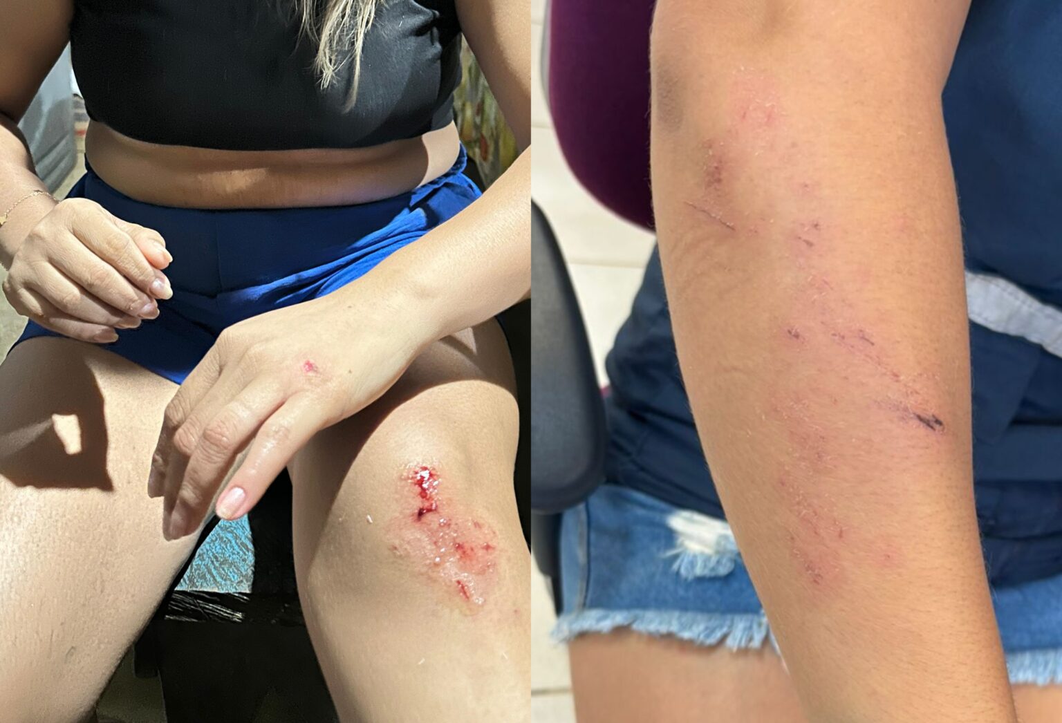 Violência em Polo de Saúde Yanomami: Ministério Retira Equipe Após Ataque