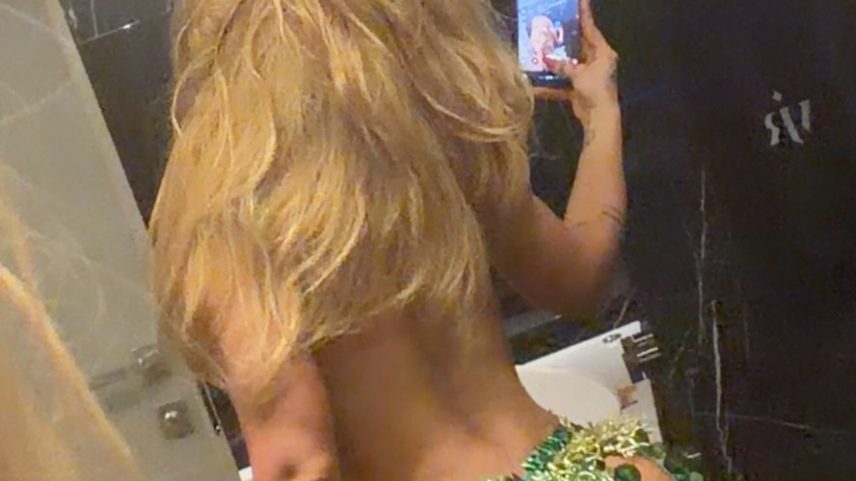 Virginia Fonseca se machuca em ensaio da Grande Rio e exibe galo na testa