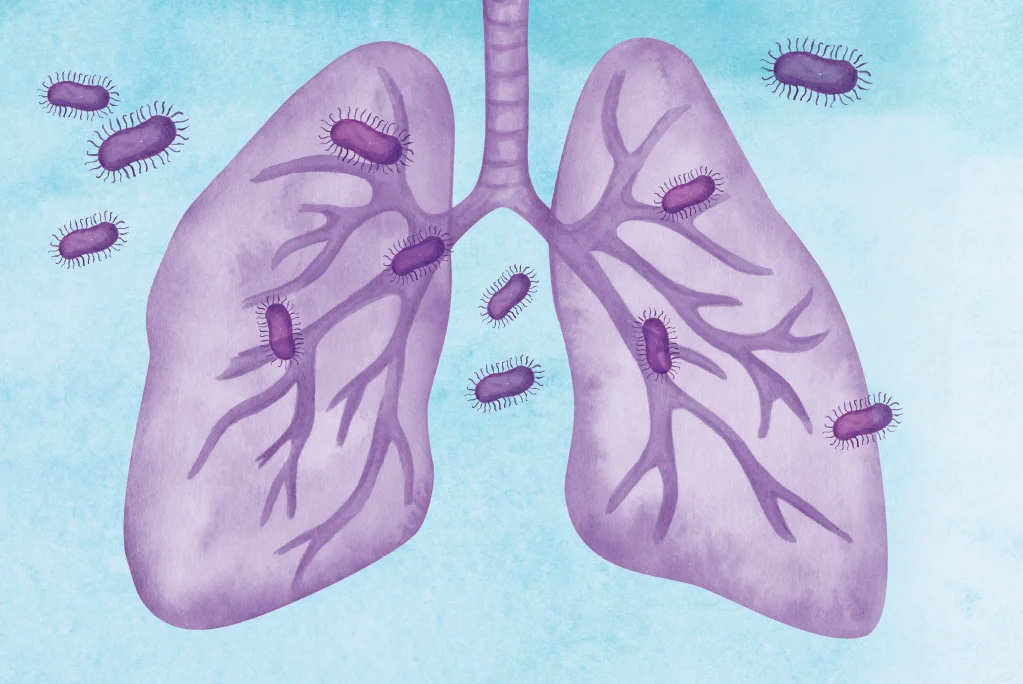 A Tuberculose e Seus Estragos: Por que a Doença Ainda Atinge Tantas Vítimas no Brasil